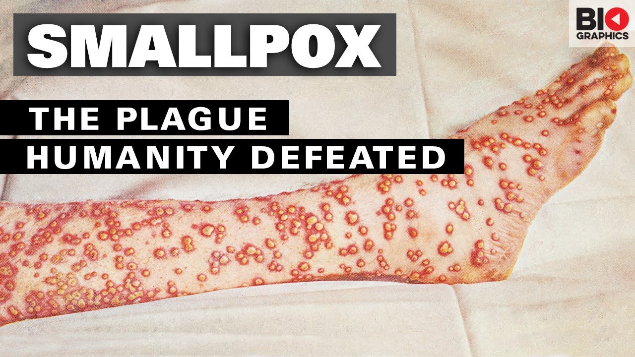 Smallpox: The Plague That Humanity Defeated