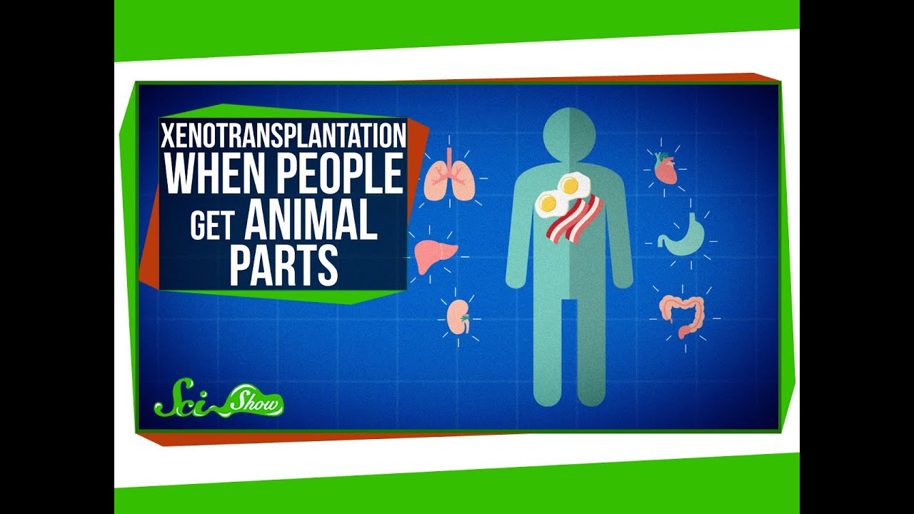 Xenotransplantation: When People Get Animal Parts