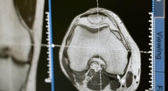 Automated Medical Imaging: Your Personal Guide